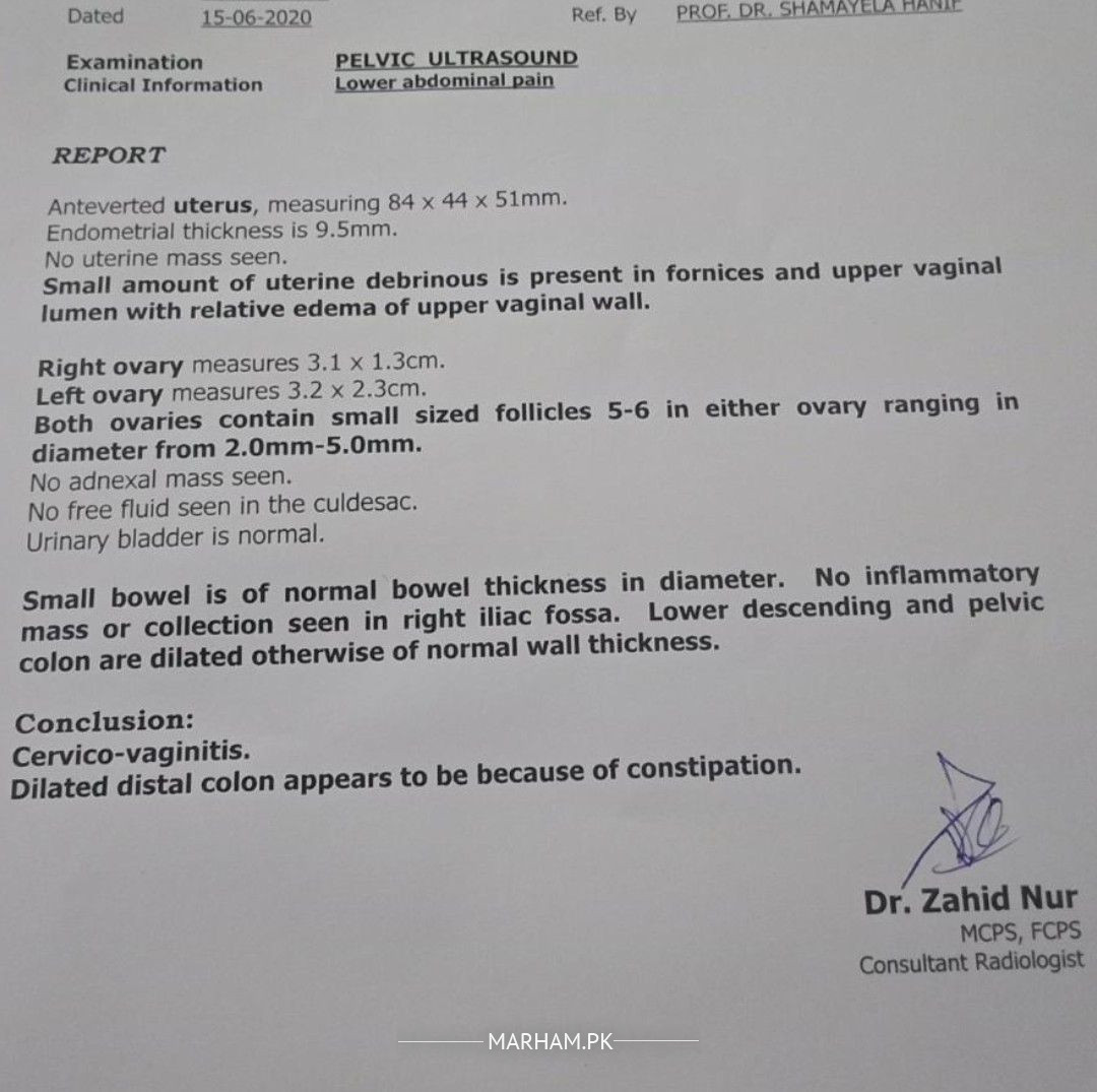 Apple Evaluates Intel for the Advancement of Future M-Series Processors, As Per Report