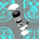 Did Neuralink Gamble Incorrectly?